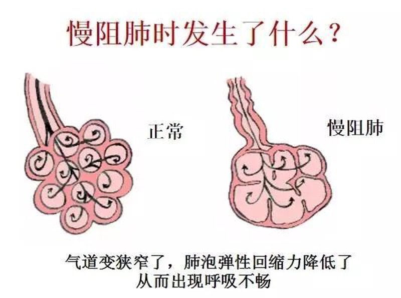 探访济南哮喘病医院：呼吸健康的守护神