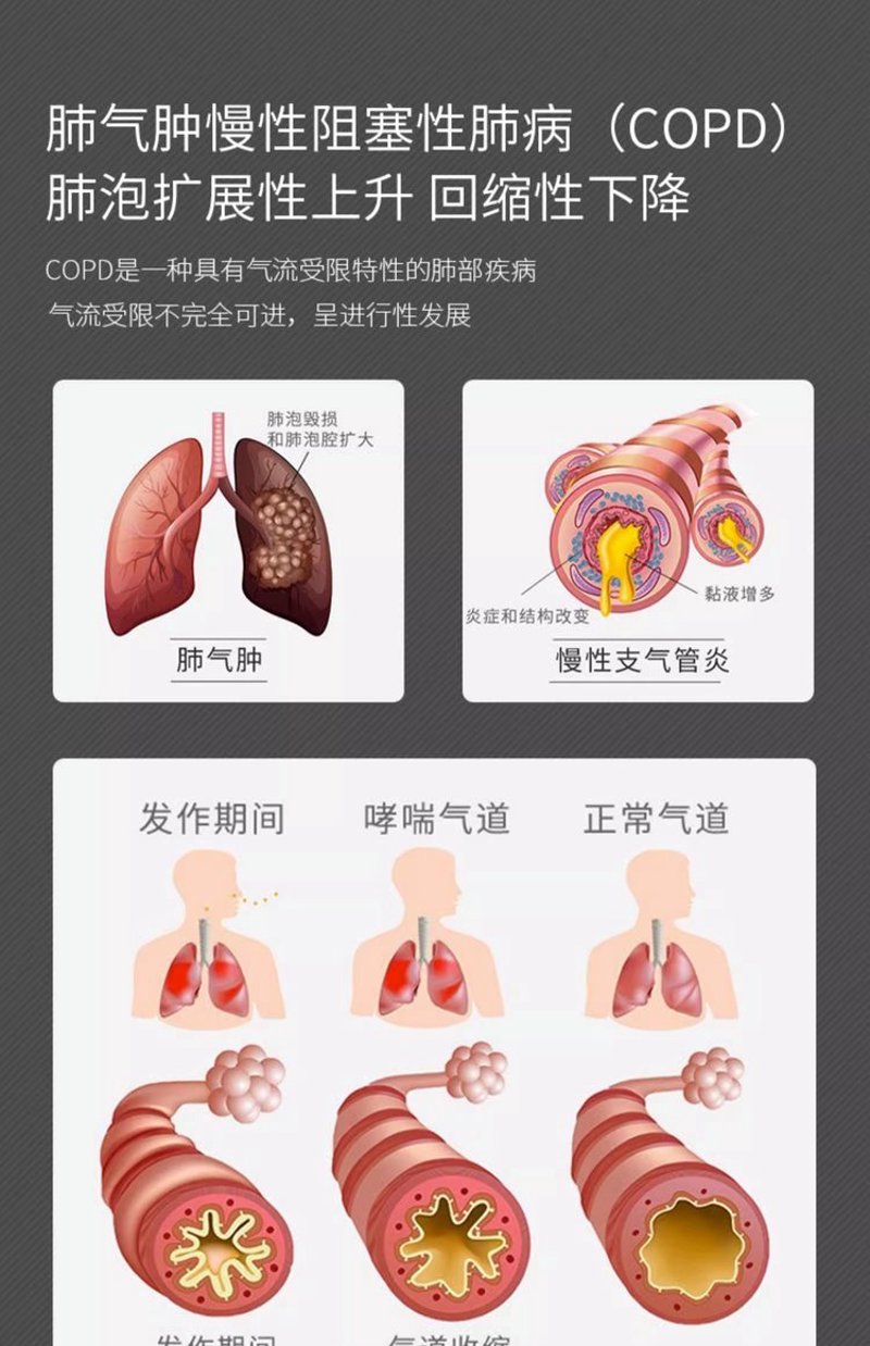 哮喘专科医院：呼吸健康的守护者